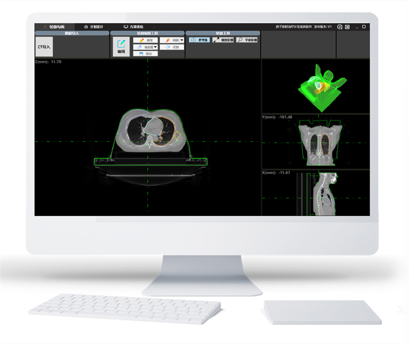 放疗影像勾画工作站